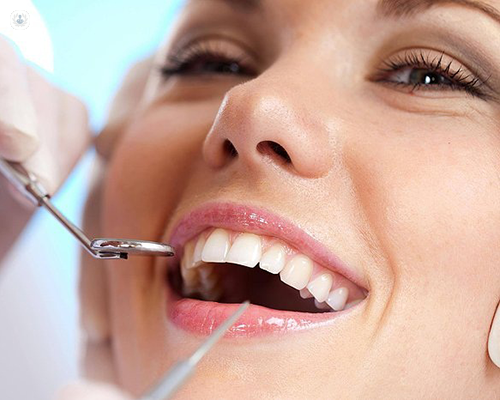 Dental Implants in Odessa: A Comprehensive Guide to Restoring Your Smile