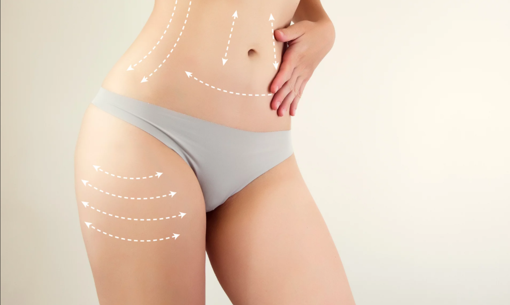 How to Build Trust with Your Full Body Best Liposuction Surgeons in Dubai