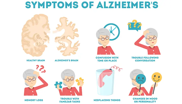 Understanding Alzheimer’s Disease Treatment: Expert Insights and Solutions