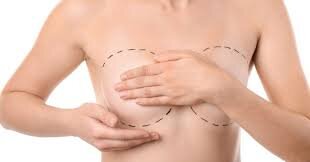 The Importance of Aftercare in Breast Lift Recovery: Insights from the Best Breast Lift Surgeons in dubai